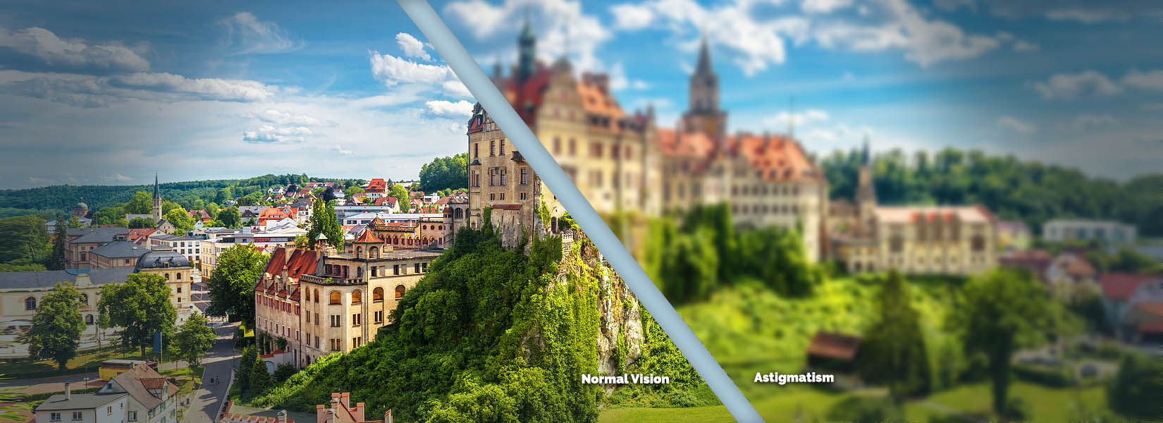 Astigmatism Treatment in Angel's Triangle